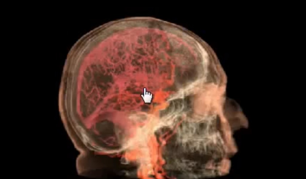 IRM cerveau orgasme